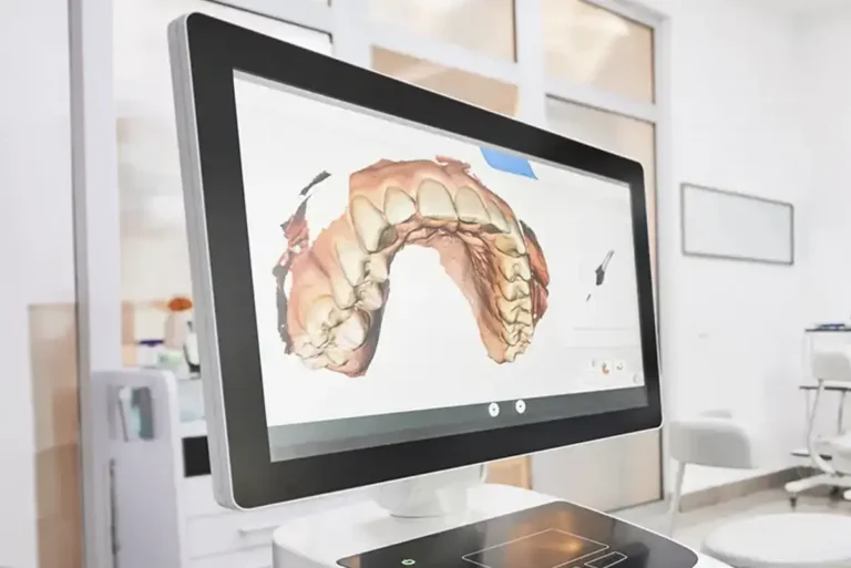Intraoral Digital Scanner in Hopewell, VA at City Point Dental