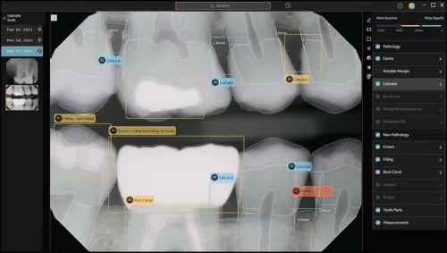 Pearl AI-Assisted Diagnostic Scanning at City Point Dental