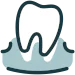 Tooth Extractions